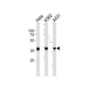 Annexin A1 (ANXA1) Antibody