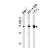Ubiquitin Carboxyl Terminal Hydrolase L1 (UCHL1) Antibody