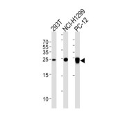 Ubiquitin Carboxyl Terminal Hydrolase L1 (UCHL1) Antibody