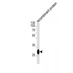Bcl-2-Like Protein 1 (BCL2L1) Antibody