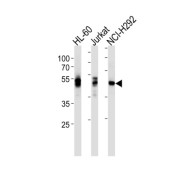 Proto-Oncogene Tyrosine-Protein Kinase LCK (LCK) Antibody