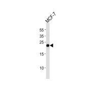 O-6-Methylguanine DNA Methyltransferase (MGMT) Antibody