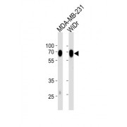 5'-Nucleotidase / CD73 (NT5E) Antibody