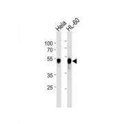 Serine/threonine-Protein Kinase VRK1 (VRK1) Antibody