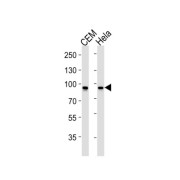 Signal Transducer And Activator of Transcription 1 (STAT1) Antibody