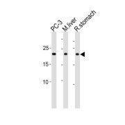 Proteasome Subunit Beta Type 2 (PSMB2) Antibody
