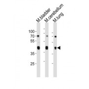Cholecystokinin Receptor Type A (M Cckar) Antibody
