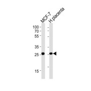 Prolactin Receptor (PRLR) Antibody