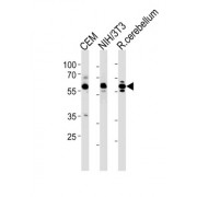 5'-AMP-Activated Protein Kinase Catalytic Subunit Alpha-1 (PRKAA1) Antibody