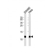 Cytochrome C Oxidase Subunit NDUFA4 (NDUA4) Antibody