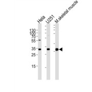 RNA Polymerase II Subunit C (POLR2C) Antibody