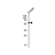 Monoamine Oxidase (MAO) Antibody