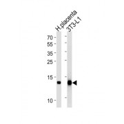 Fatty Acid-Binding Protein 4, Adipocyte (FABP4) Antibody