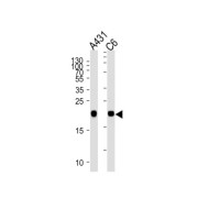 GTPase NRas (NRAS) Antibody