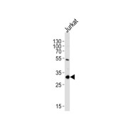 Exosome Component 2 (EXOSC2) Antibody