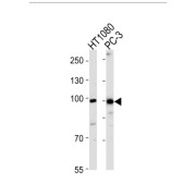 Zinc Finger Protein 560 (ZNF560) Antibody