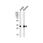 Caspase 3 (CASP3) Antibody