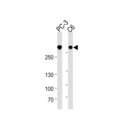 Filamin-A (FLNA) Antibody