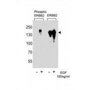 ErbB2 (pY1222) Antibody