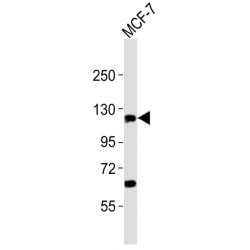 Zinc Finger Protein 217 (ZNF217) Antibody