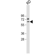 WB analysis of RD whole cel lysates, using SMTNL1 antibody (1/2000 dilution). Predicted band size: 43 kDa.