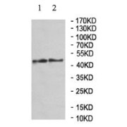 WB analysis of Fetal liver (lane 1) and Fetal kidney (lane 2) tissue using Kelch Domain-Containing Protein 2 (KLHDC2) Antibody.