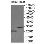 WB analysis of HeLa and HaCaT cell lysates, using DHRS2 antibody.