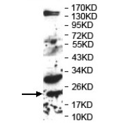 WB analysis of fetal brain lysate.