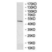 Western blot analysis of Human muscle tissue lysate using N-Acetylglucosamine-6-Phosphate Deacetylase (AMDHD2) Antibody.