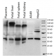 Placenta-Specific Protein 1 (PLAC1) Antibody