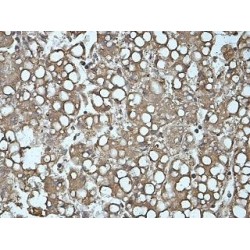 Mesoderm Induction Early Response Protein 2 (MIER2) Antibody