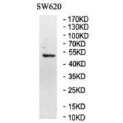 WB analysis of SW620 cell lysates.