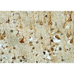 Zinc Finger Homeobox Protein 3 (ZFHX3) Antibody