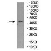 WB analysis of Human Brain tissue lysate, using APLNR antibody (1/500 dilution).
