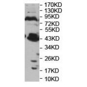 Western blot analysis of A549 cell lysates using Patatin Like Phospholipase Domain Containing 8 (PNPLA8) Antibody.