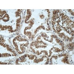 Ataxin 3 / ATX3 (ATXN3) Antibody