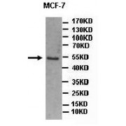 WB analysis of MCF-7 cell lysates, using ATXN3 antibody (1/500 dilution).