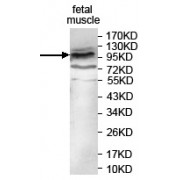WB analysis of fetal muscle tissue, using EMC1/KIAA0090 antibody (1/500 dilution).