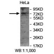 Western blot analysis of HeLa cell lysates, using ZNF595 antibody.