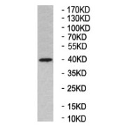 Western blot analysis of Rat brain tissue using Paraneoplastic Antigen Ma1 Homolog Antibody.