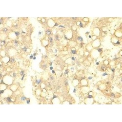 Phytanoyl-CoA Dioxygenase Domain-Containing Protein 1 (PHYHD1) Antibody