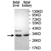 Western blot analysis of fetal liver and fetal kidney tissue, using PHYHD1 antibody (1/1000 dilution).