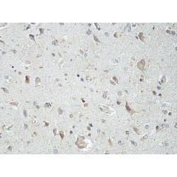 GATOR Complex Protein DEPDC5 (DEPDC5) Antibody