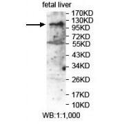 WB analysis of fetal liver lysate, using LRIG2 antibody (1/1000 dilution).