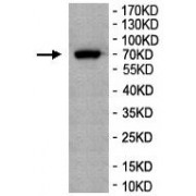 WB analysis of Mouse Liver tissue lysate, using PLCZ1 antibody (1/500 dilution).