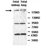WB analysis of fetal kidney and lung lysate, using ANKRD36 antibody (1/500 dilution).