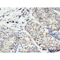 Ubiquitin Carboxyl-Terminal Hydrolase 29 (USP29) Antibody