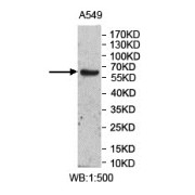 UDP-Glucuronosyltransferase 2A3 (UGT2A3) Antibody