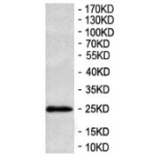 WB analysis of mouse muscle tissue.