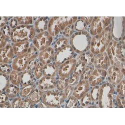 Metalloproteinase Inhibitor 3 (TIMP3) Antibody